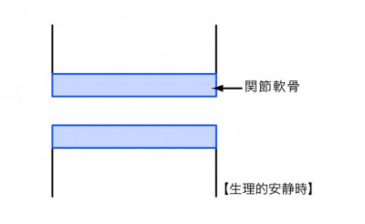 関節軟骨1