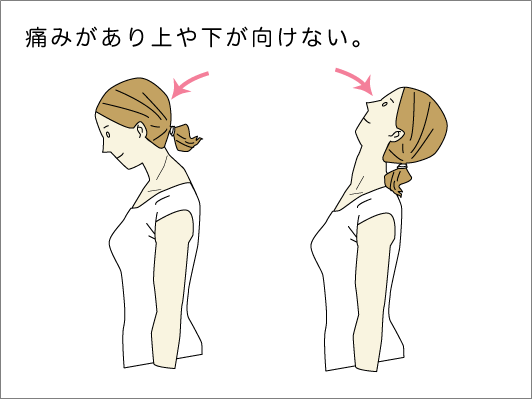 寝違え 上 を 向け ない