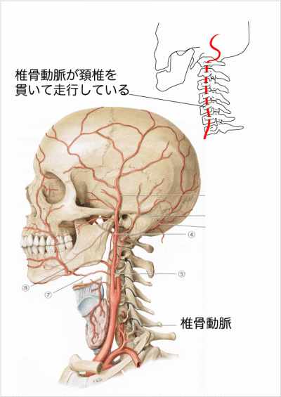 椎骨動脈合体