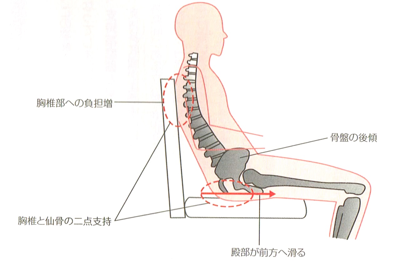 座る と 痛い 腰痛